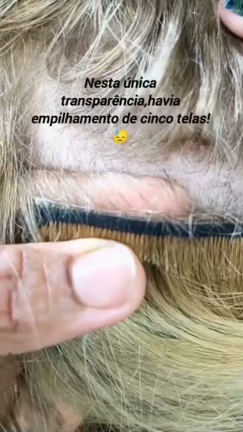 Troca de método! Ela estava usando na fita adesiva. Mas nâo era qualquer fita. Estava colocando de uma forma muito grosseira. Nesta única transparência havia um empilhamento de cin